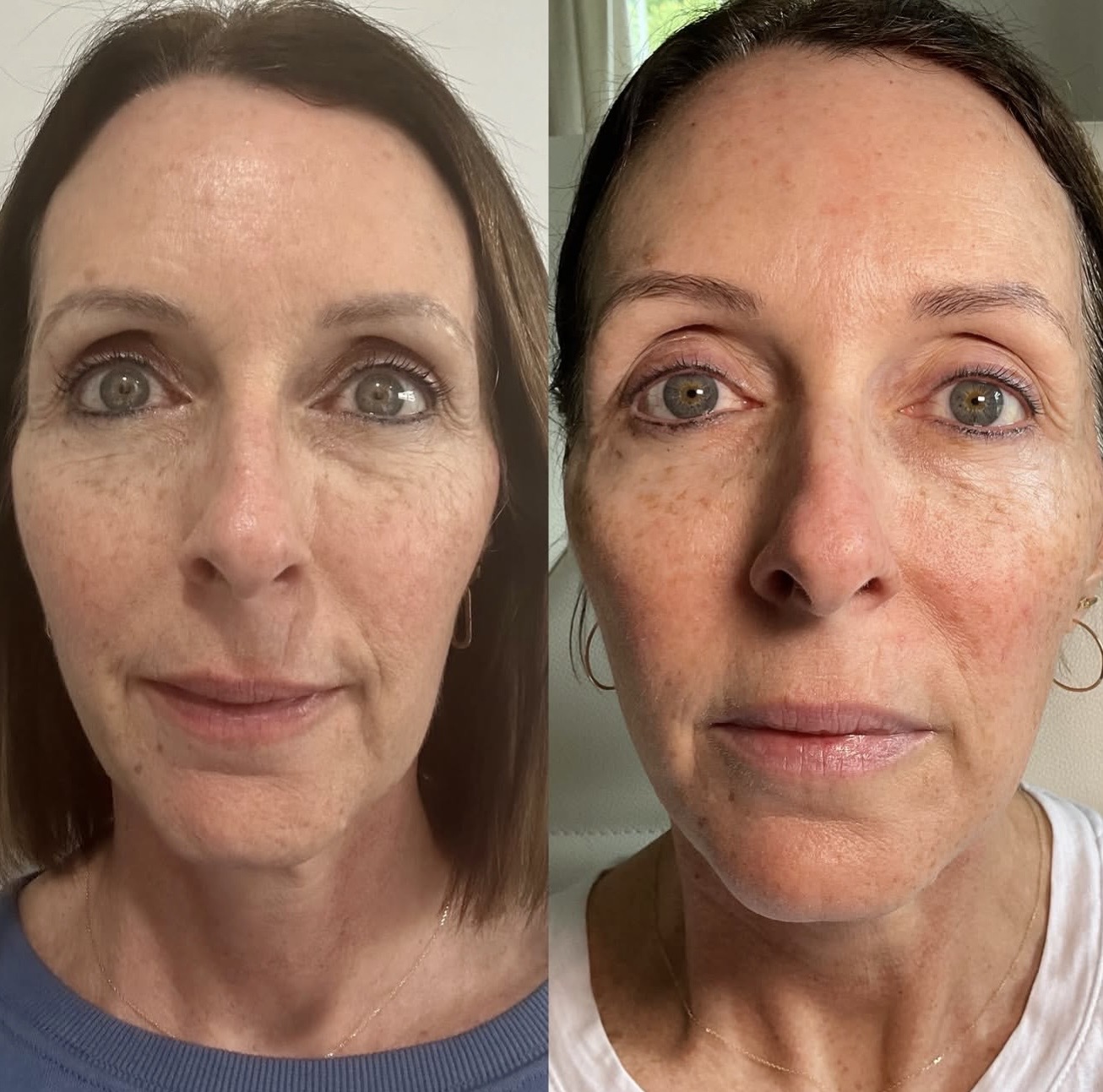 Client results — Marisa T.