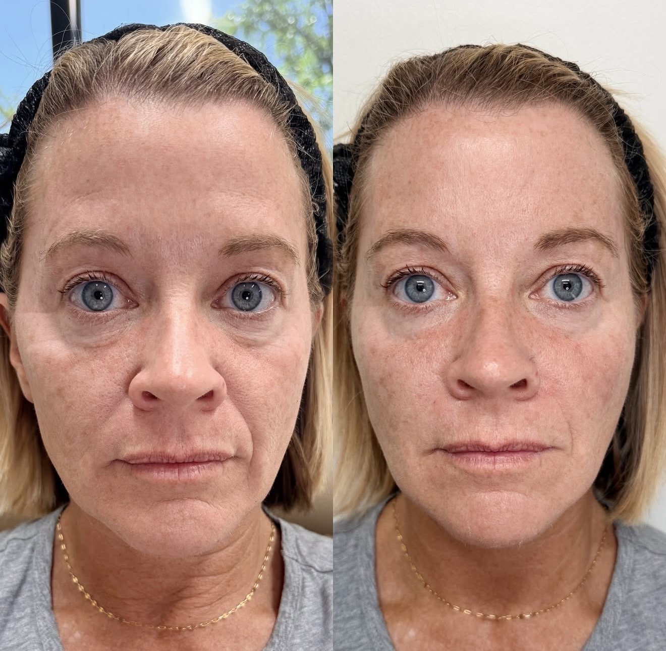 Client results — Danielle R.